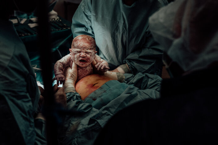 mother assisted c-section keizersnede birth day geboortefotografie